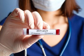 Coronavirus Coronavirus